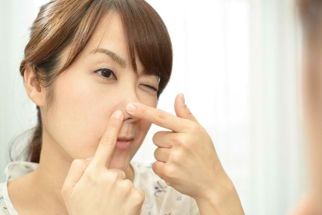 Cara Menghilangkan Komedo Putih dengan Mudah dan Membuat Kulit Wajah Terlihat Bersih