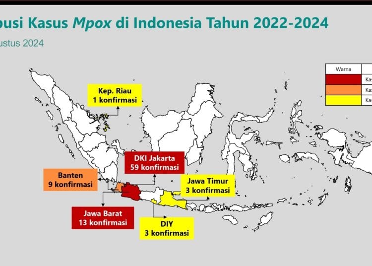 Kemenkes Umumkan 88 Kasus Monkeypox di Indonesia, Mayoritas di DKI Jakarta