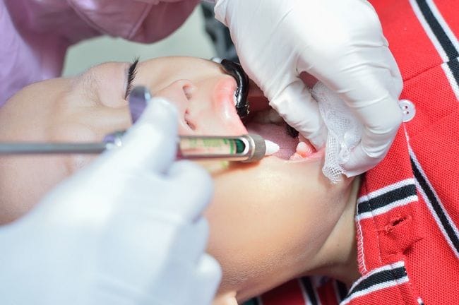 Cabut Gigi, Kenali Berbagai Kondisi yang Mendasarinya