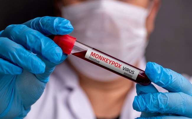 Virus Cacar Monyet, Kenali Gejala, Cara Penularan, serta Pencegahannya