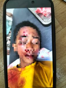 Unit Lantas Polsek Wonomulyo Tanggap Cepat Tangani Lakalantas Antara Pengendara Motor dan Pejalan Kaki di Kelurahan Sidodadi