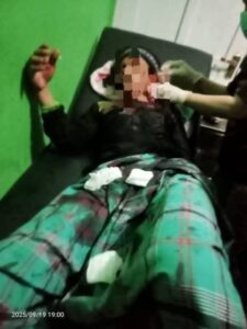 Polres Polman Amankan Pelaku Penganiayaan Hingga Tewaskan Ayah Kandung di Tutar