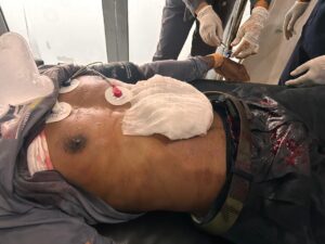 Kasus Penganiayaan Menggunakan Senjata Tajam di Polman, Pelaku Diamankan Polisi