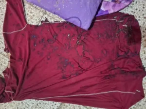 Resmob Polsek Tamalate Berhasil Tangkap Pelaku Penyiraman Air Keras dalam Waktu Kurang dari 3 Jam, Identitasnya Pacar Korban